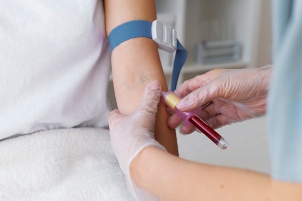 Clotting Tests: A Vital Check for Your Health